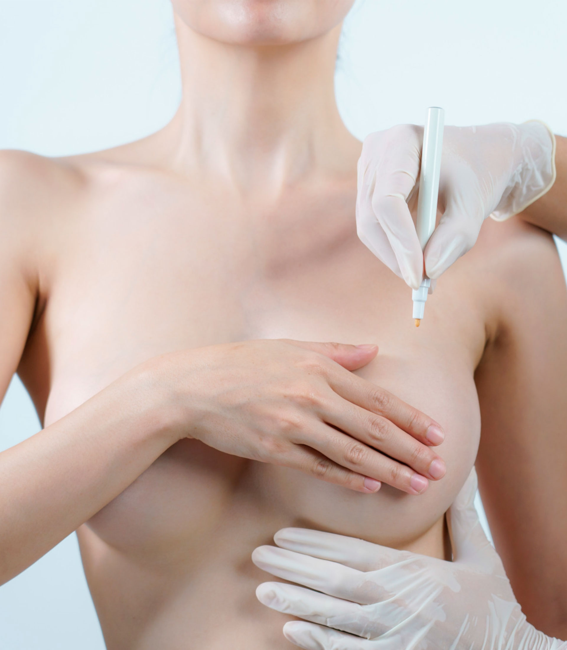 Revisão do Implante de Mamas